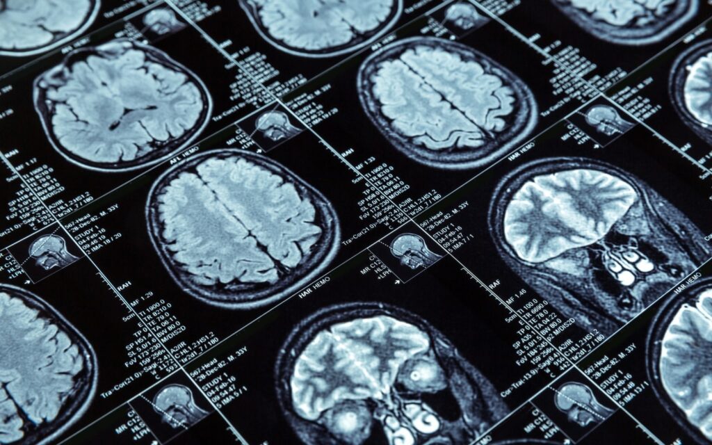 Medical-Imaging-and-Diagnostics