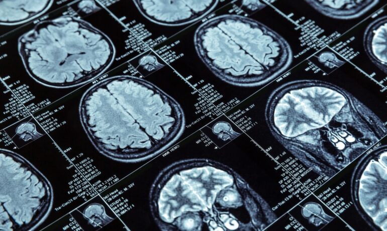 Medical-Imaging-and-Diagnostics